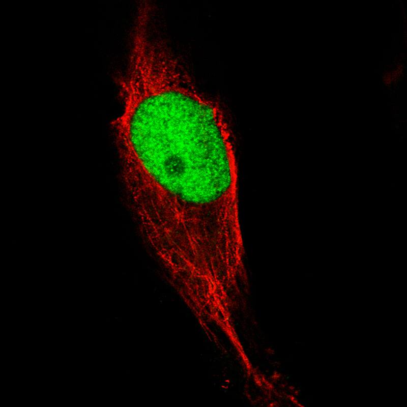 Staining of U-2197cells using the Anti-KLF4 monoclonal antibody) . 