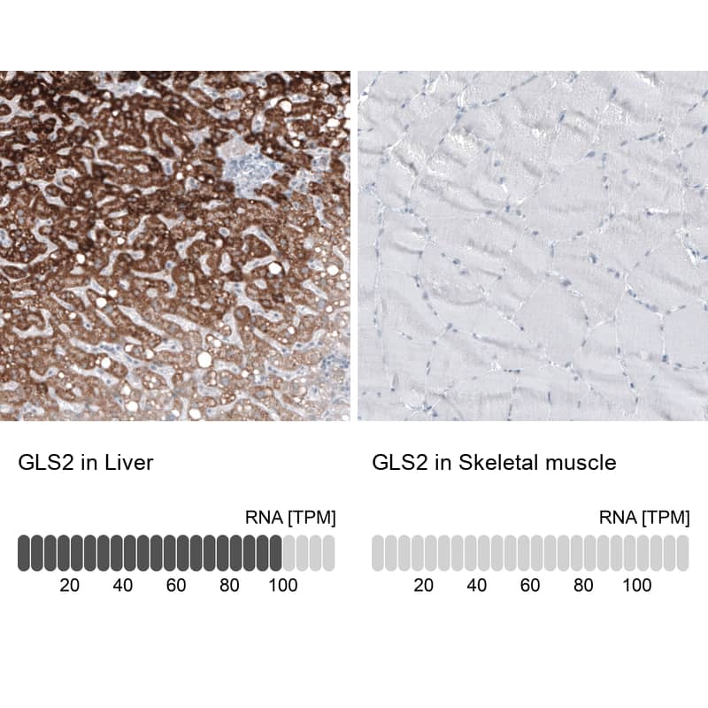Analysis in human liver and skeletal muscle tissues using NBP3-44209 antibody. Corresponding GLS2 RNA-seq data are presented for the same tissues.
