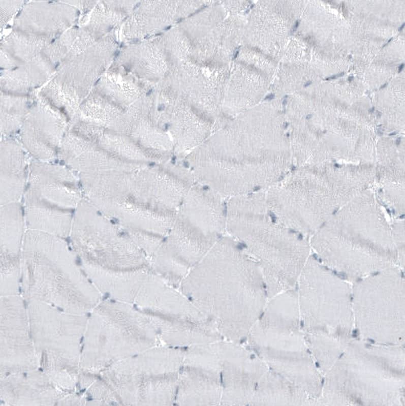 Staining of human skeletal muscle shows no positivity in myocytes as expected.