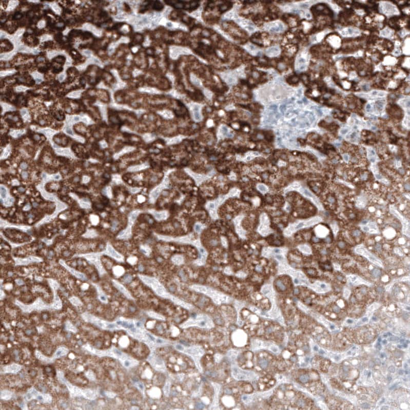 Staining of human liver shows strong granular cytoplasmic positivity in hepatocytes.