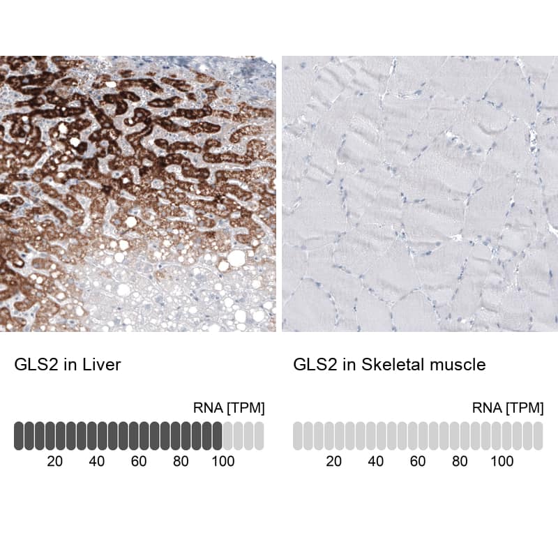 Analysis in human liver and skeletal muscle tissues using NBP3-44210 antibody. Corresponding GLS2 RNA-seq data are presented for the same tissues.