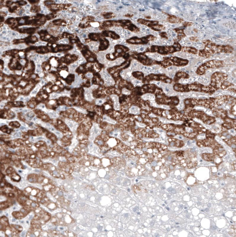 Staining of human liver shows strong granular cytoplasmic positivity in hepatocytes.
