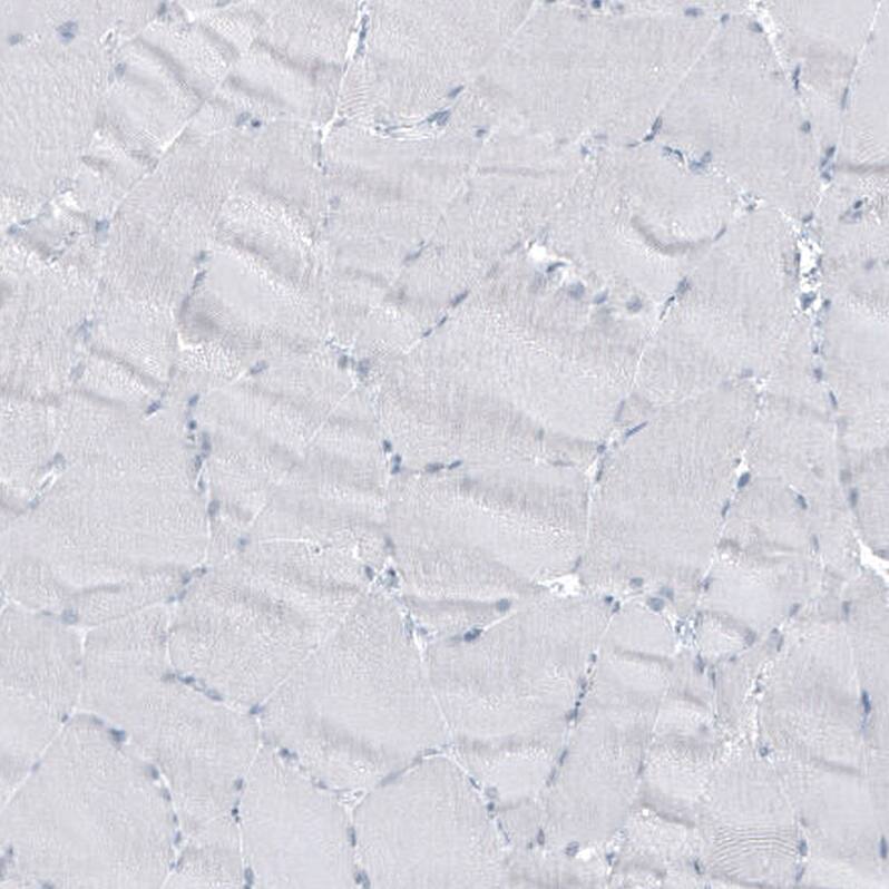 <b>Orthogonal Strategies Validation. </b>Staining of human skeletal muscle shows no positivity in myocytes as expected.