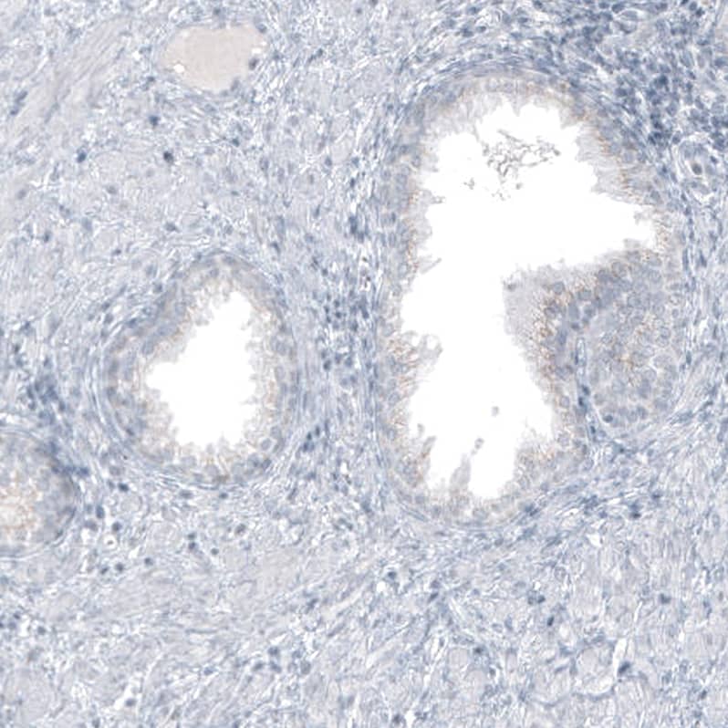 Staining of human prostate shows no positivity in glandular cells as expected.