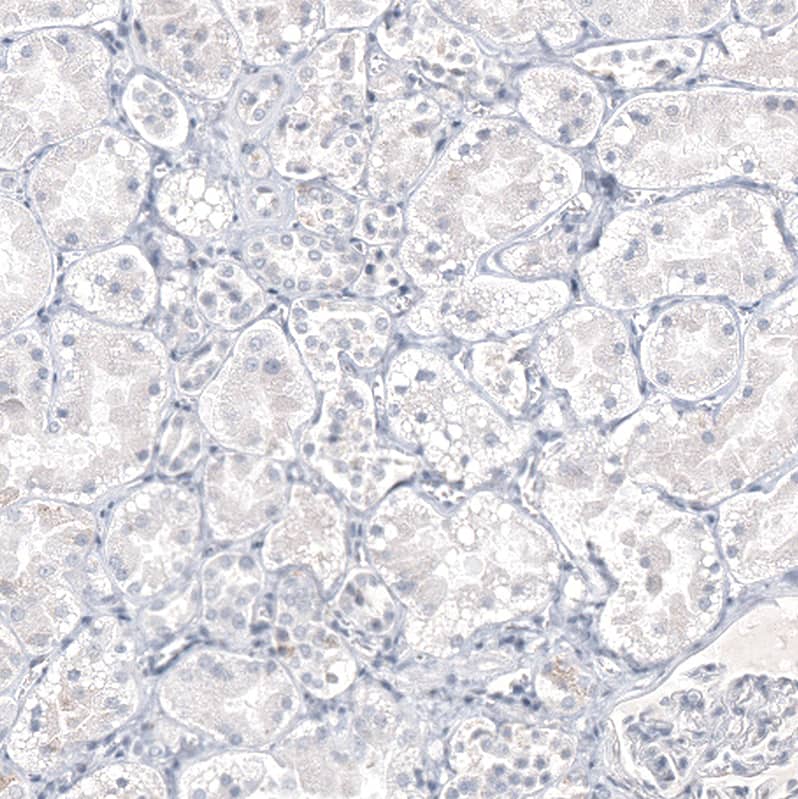Staining of human kidney shows no positivity in cells in tubules as expected.
