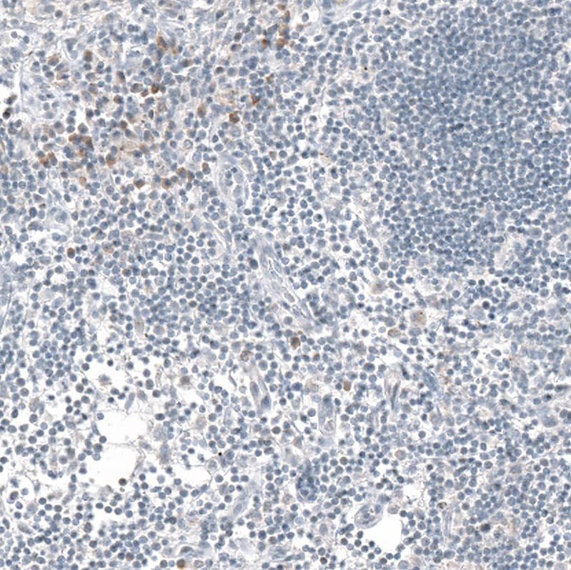 Staining of human lymph node shows moderate cytoplasmic positivity in a subset of lymphoid cells.