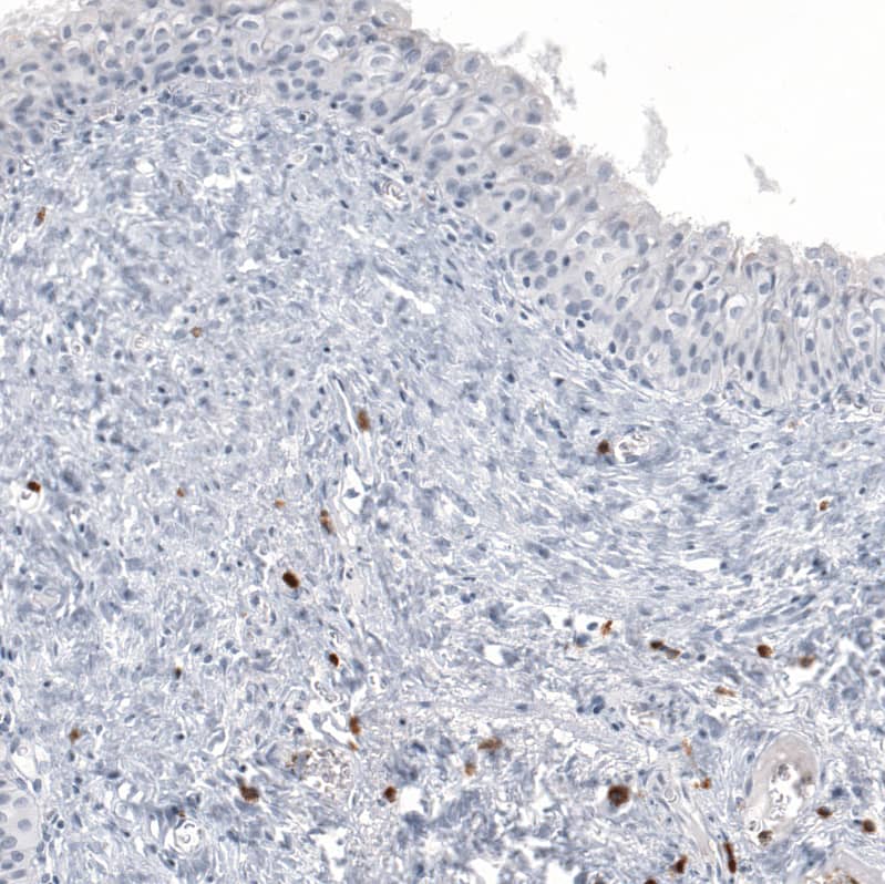 Staining of human urinary bladder shows strong cytoplasmic positivity in lymphoid cells.