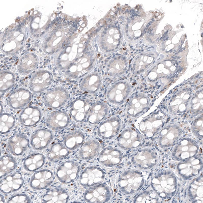 Staining of human rectum shows moderate cytoplasmic positivity in lymphoid cells.