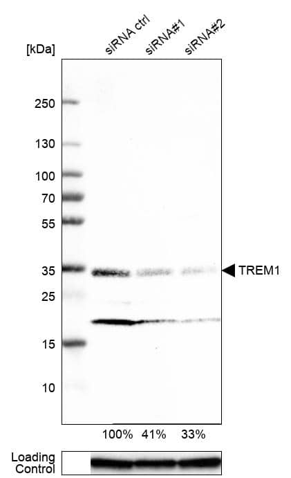 Analysis in U-87MG ATCC cells transfected with control siRNA, target specific siRNA probe #1 and #2, using Anti-TREM1 antibody. Remaining relative intensity is presented. Loading control: Anti-GAPDH.