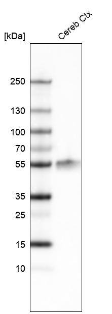 Analysis in mouse cerebral cortex tissue.