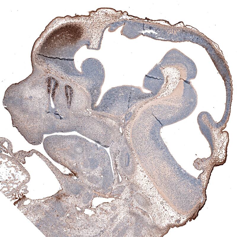 Staining of mouse embryo E11 shows  strong nuclear positivity in developing cerebral cortex and sensory organs.
