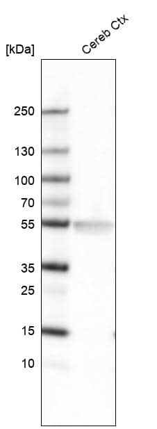 Analysis in human cerebral cortex tissue.
