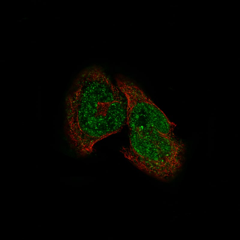 Staining of RH-30 cells, showing specific staining in the nucleoplasm and cytosol in green. Microtubule- and nuclear probes are visualized in red and blue, respectively (where available).