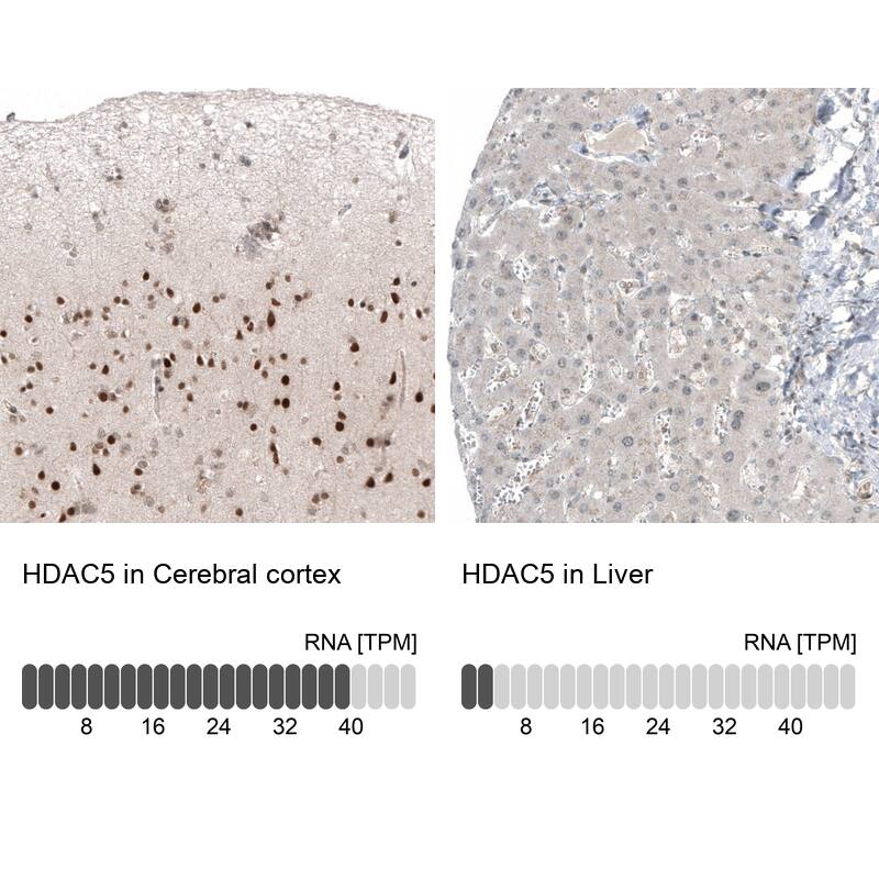 Analysis in human cerebral cortex and liver tissues using NBP3-44217 antibody. Corresponding HDAC5 RNA-seq data are presented for the same tissues.