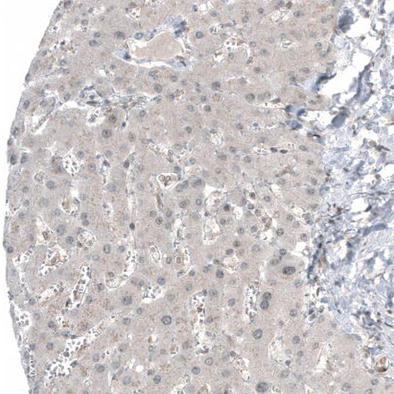 Staining of human liver shows no positivity in hepatocytes as expected.