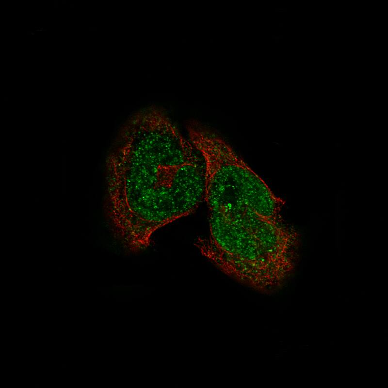 Staining of RH-30 cells using the Anti-HDAC5 monoclonal antibody) . 