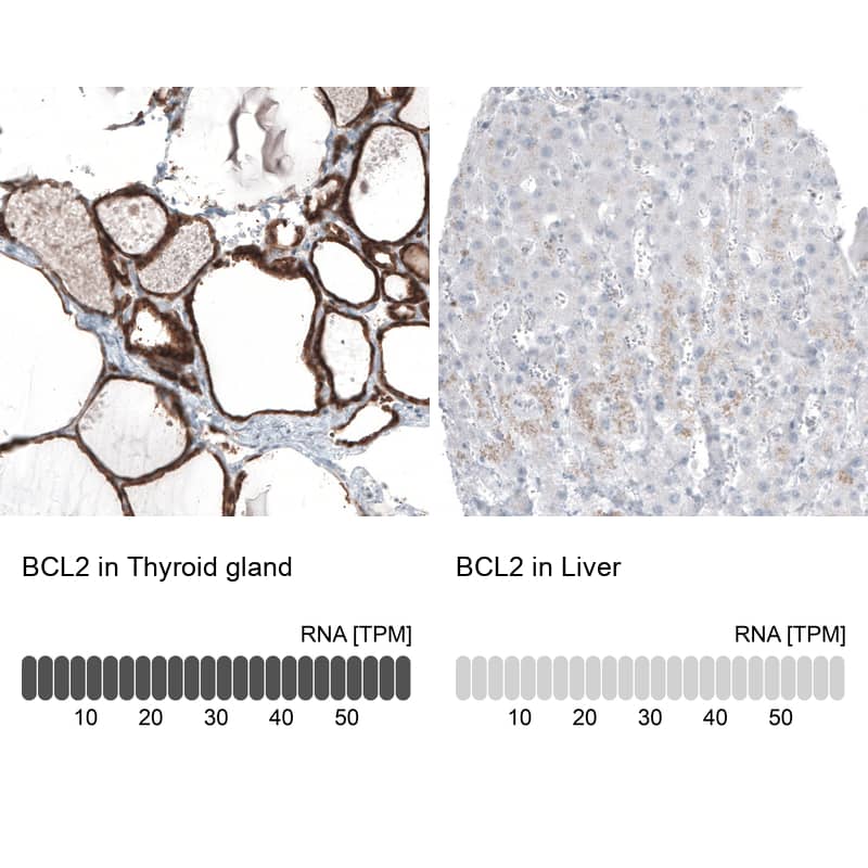 Analysis in human thyroid gland and liver tissues using NBP3-44218 antibody. Corresponding Bcl-2 RNA-seq data are presented for the same tissues.