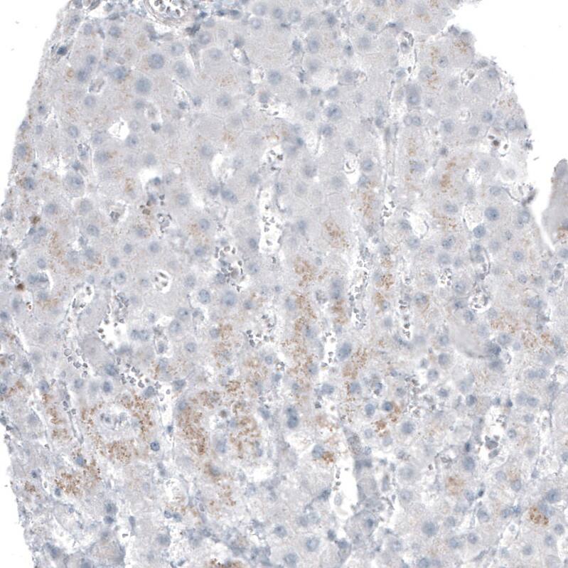Staining of human liver shows negative to no positivity in hepatocytes as expected.