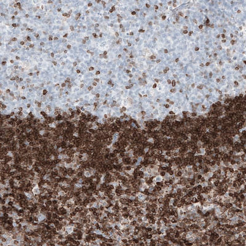 Staining of human lymph node shows strong cytoplasmic positivity in non-germinal center cells.