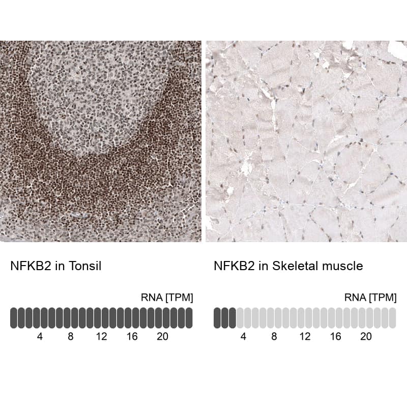 Analysis in human tonsil and skeletal muscle tissues using NBP3-44219 antibody. Corresponding NFkB2/NFkB p100 RNA-seq data are presented for the same tissues.