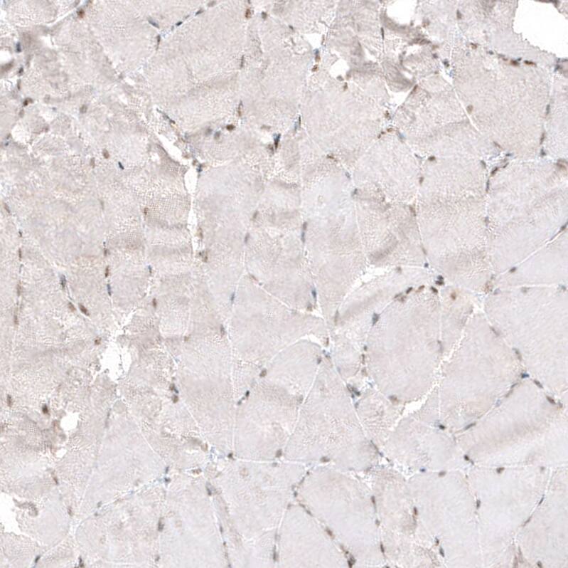 Staining of human skeletal muscle shows very weak nuclear positivity in myocytes as expected.