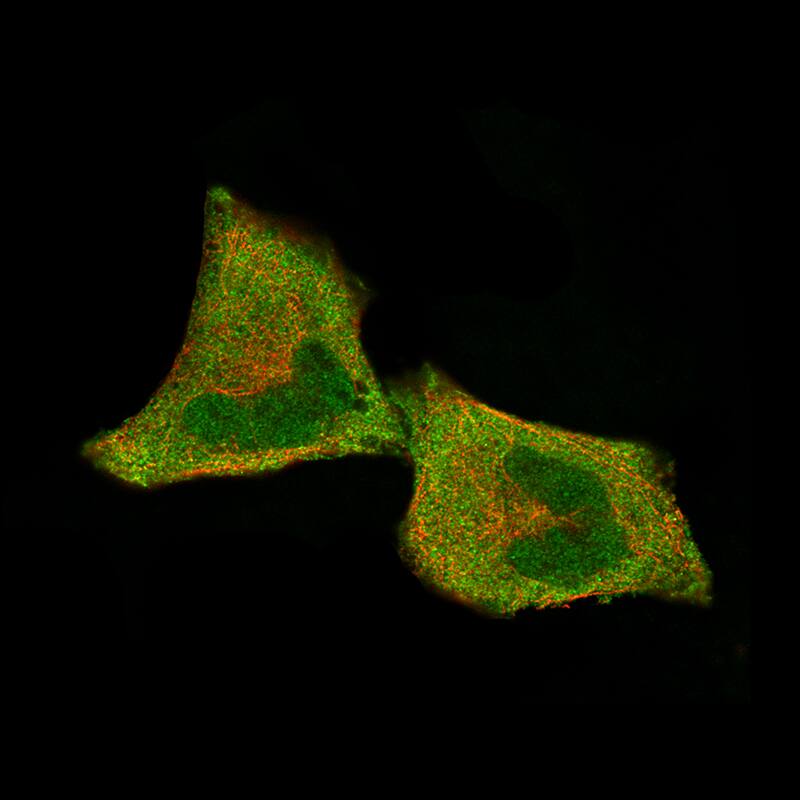 Staining of RH-30 cells, showing specific staining in the nucleoplasm and cytosol in green. Microtubule- and nuclear probes are visualized in red and blue, respectively (where available).