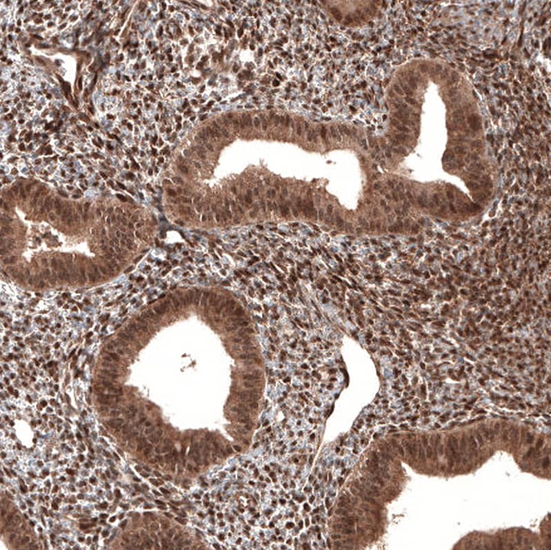 Staining of human endometrium shows strong nuclear positivity in cells in endometrial stroma.