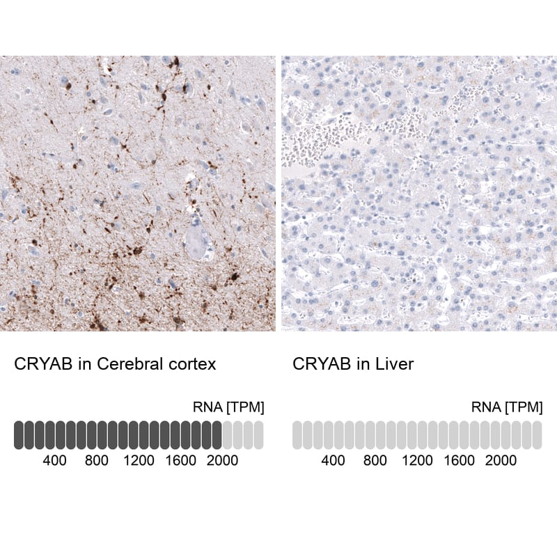 Analysis in human cerebral cortex and liver tissues using NBP3-44221 antibody. Corresponding AlphaB Crystallin/CRYAB RNA-seq data are presented for the same tissues.