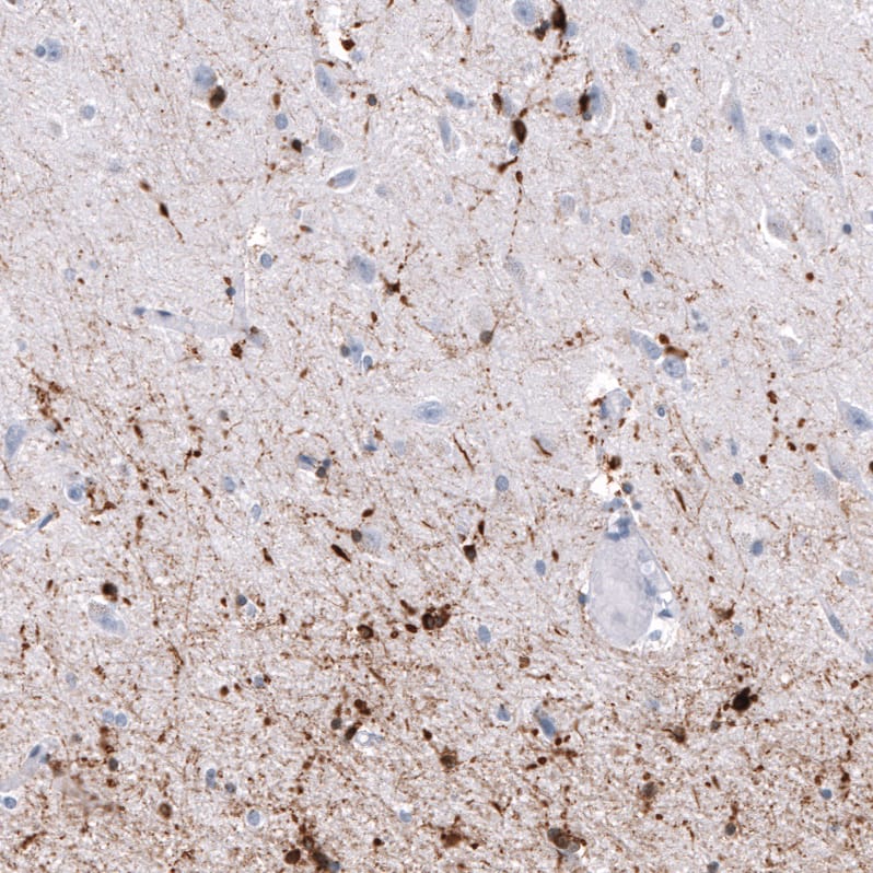 Staining of human cerebral cortex shows strong cytoplasmic positivity in oligodendrocytes.
