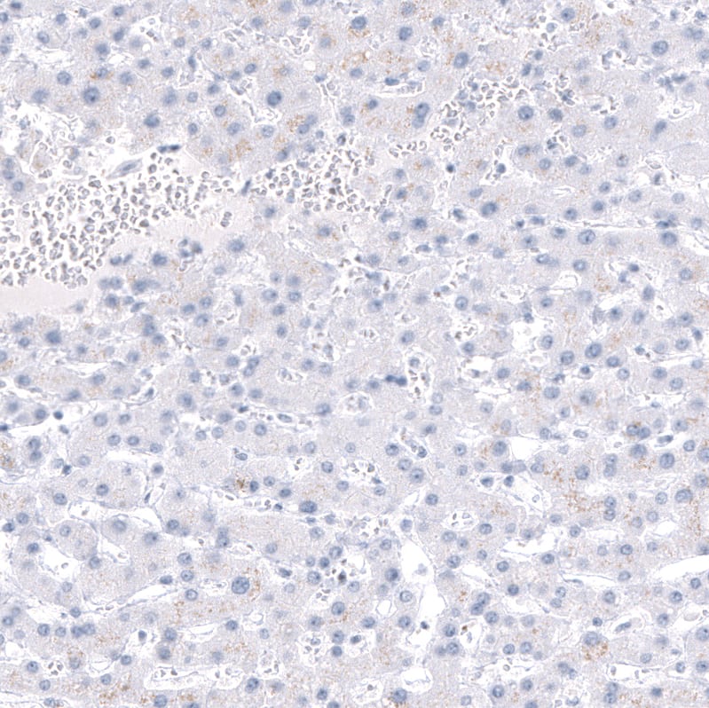 Staining of human liver shows no positivity in hepatocytes as expected.