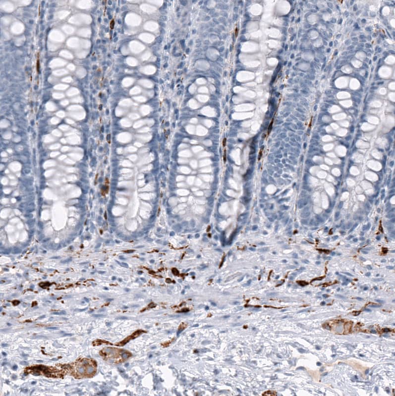 Staining of human rectum shows strong cytoplasmic positivity in peripheral ganglia and nerves.