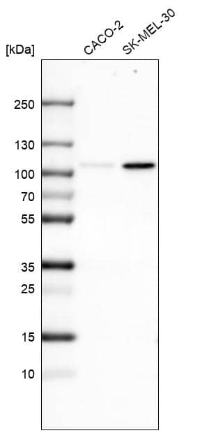 Analysis in human cell line CACO-2 and human cell line SK-MEL-30.