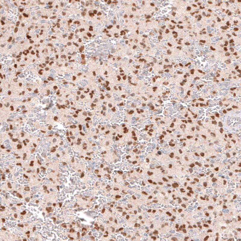 Immunohistochemistry-Paraffin SOX6 Antibody (CL5690) - Azide and BSA Free