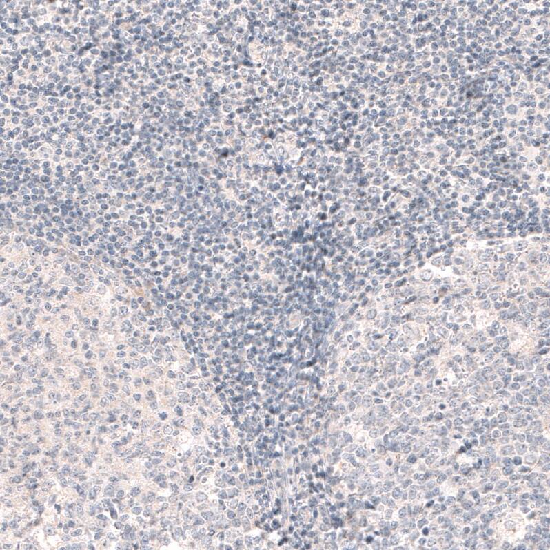 Immunohistochemistry-Paraffin SOX6 Antibody (CL5690) - Azide and BSA Free
