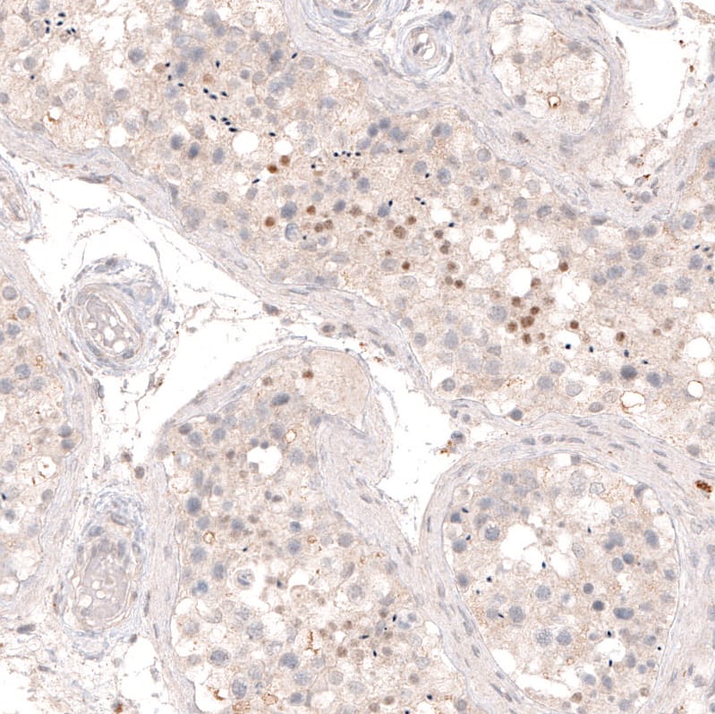 Immunohistochemistry-Paraffin SOX6 Antibody (CL5690) - Azide and BSA Free