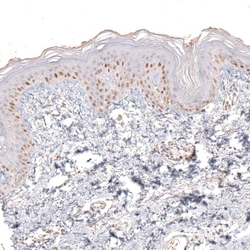 Immunohistochemistry-Paraffin SOX6 Antibody (CL5690) - Azide and BSA Free