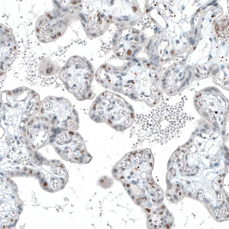 Staining of human placenta shows moderate nuclear positivity in a subset of trophoblastic cells.