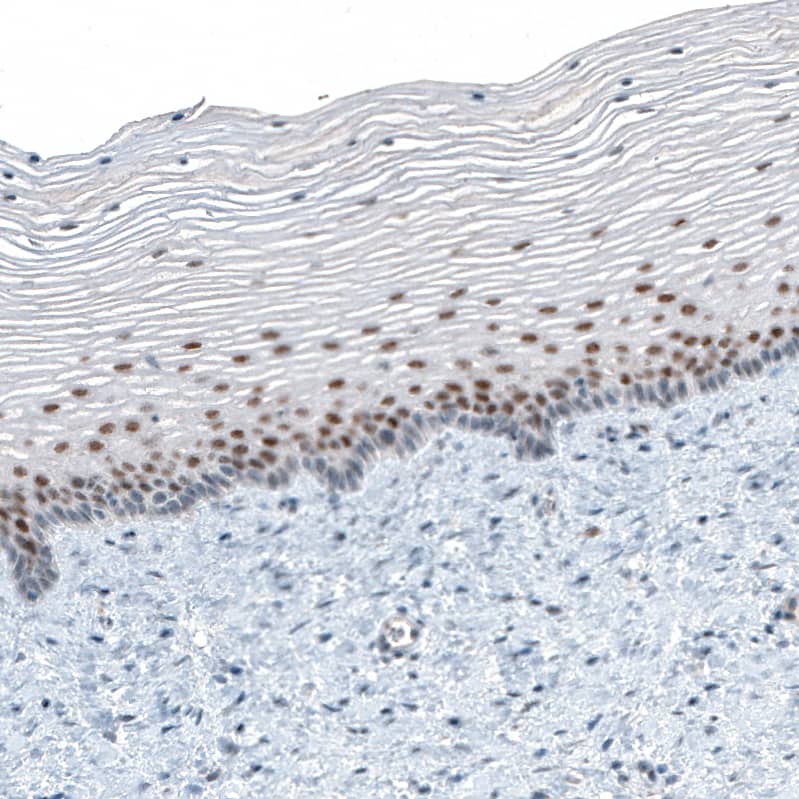 Staining of human uterine cervix shows moderate nuclear positivity in squamous epithelial cells.