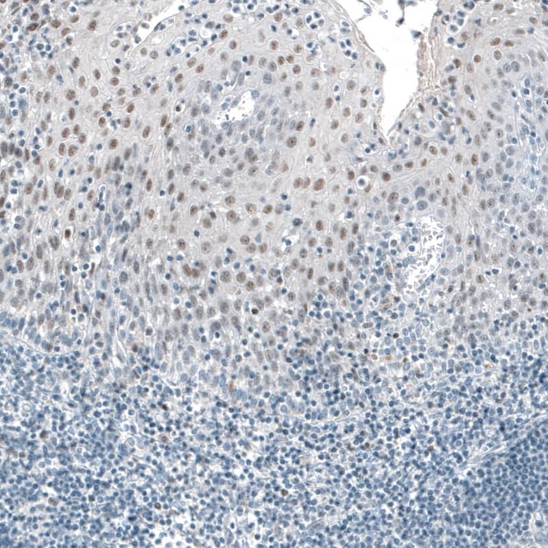 Staining of human tonsil shows weak to moderate nuclear positivity in squamous epithelial cells.
