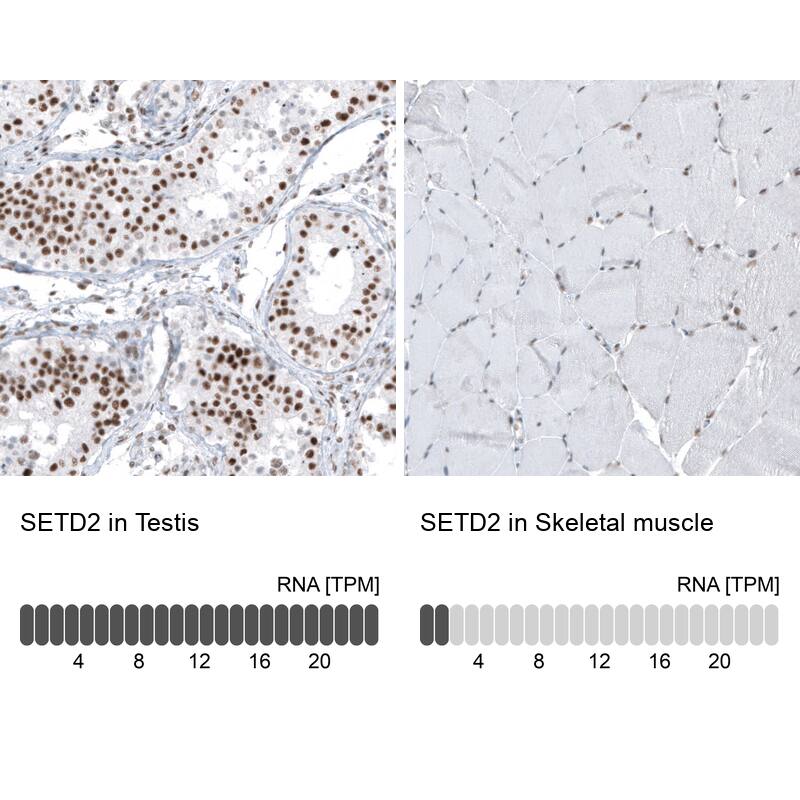 Analysis in human testis and skeletal muscle tissues using NBP3-44227 antibody. Corresponding HYPB RNA-seq data are presented for the same tissues.