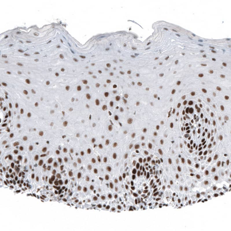 Staining of human cervix, uterine shows moderate to strong nuclear positivity in squamous epithelial cells.