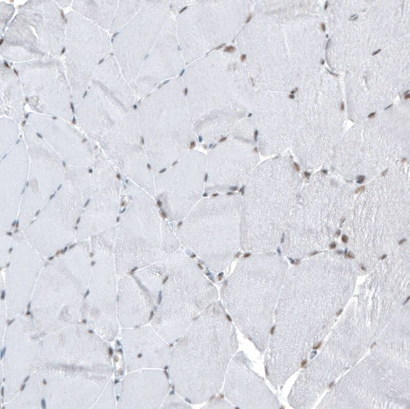 Staining of human skeletal muscle shows very weak positivity in myocytes as expected.