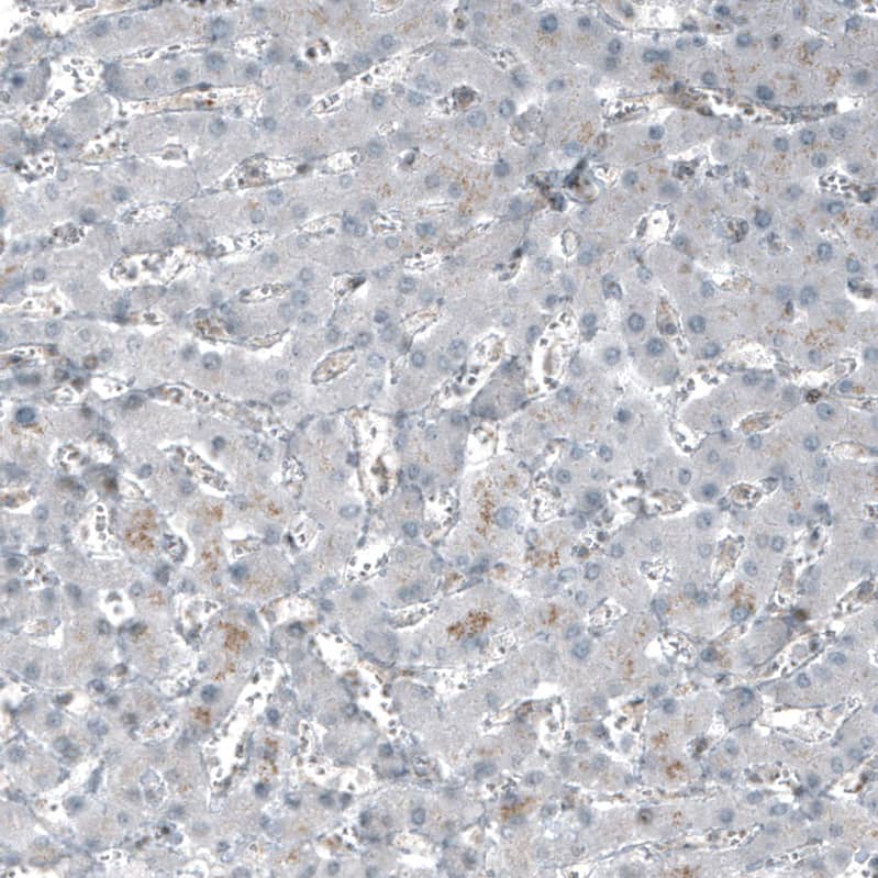 Staining of human liver shows no positivity in hepatocytes as expected.