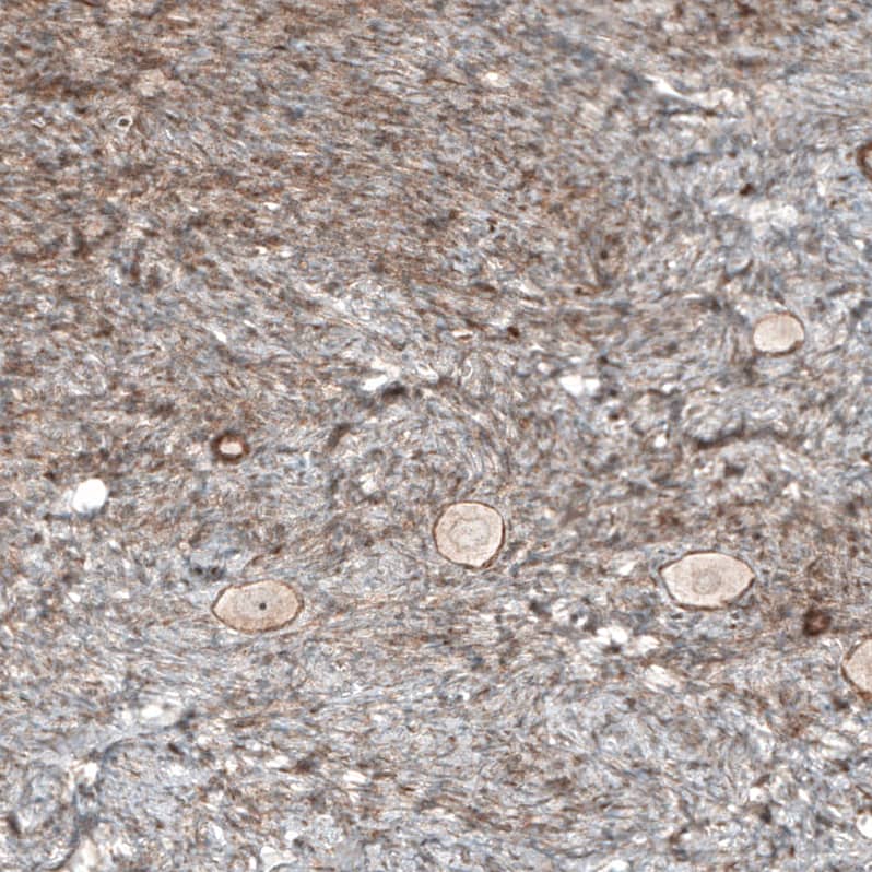 Staining of human ovary shows moderate positivity in stromal cells.