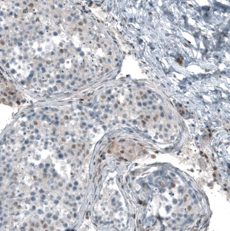 Staining of human testis shows weak to moderate nuclear positivity in Leydig cells and cells in seminiferous ducts.