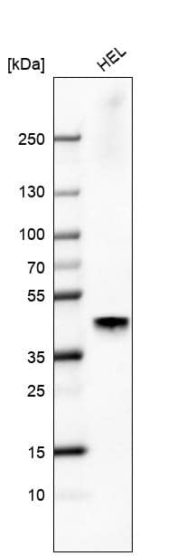 Analysis in human cell line HEL.