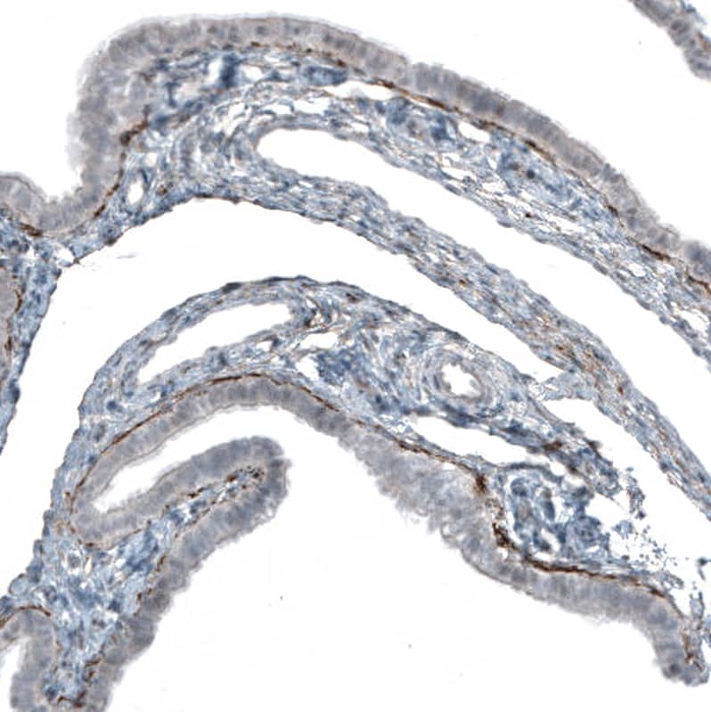 Staining of human Fallopian tube shows moderate positivity of secretion under the glandular cell layer.