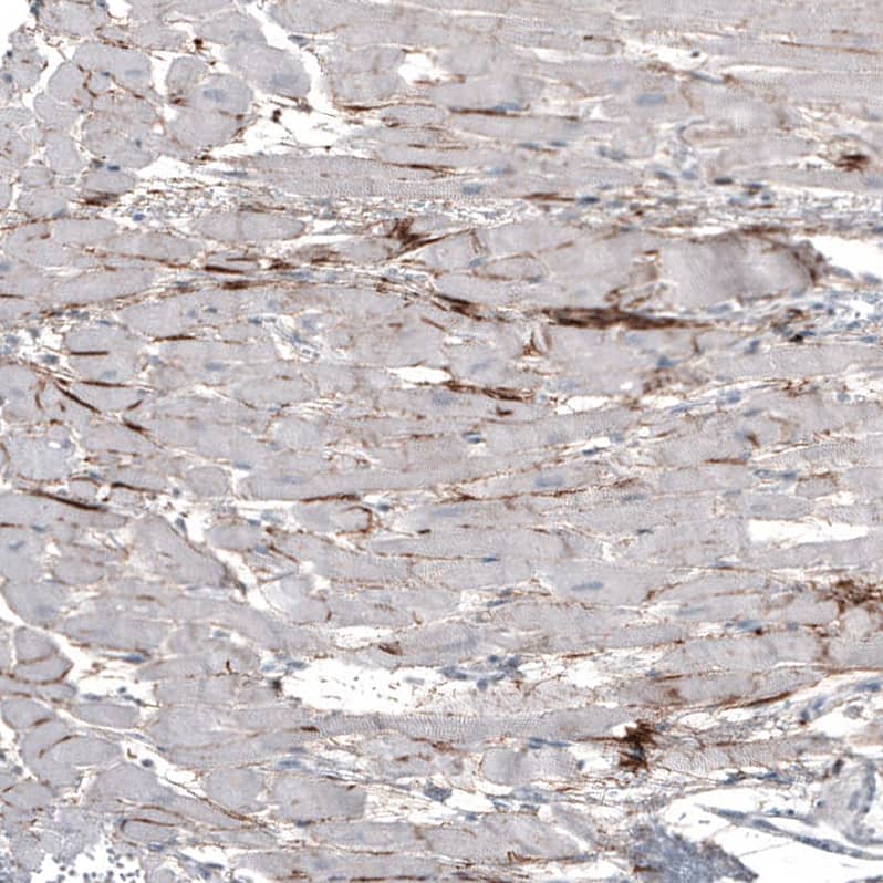 <b>Orthogonal Strategies Validation. </b>Staining of human heart muscle shows strong positivity of secretion around cardiomyocytes.