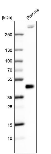 Analysis in human plasma.