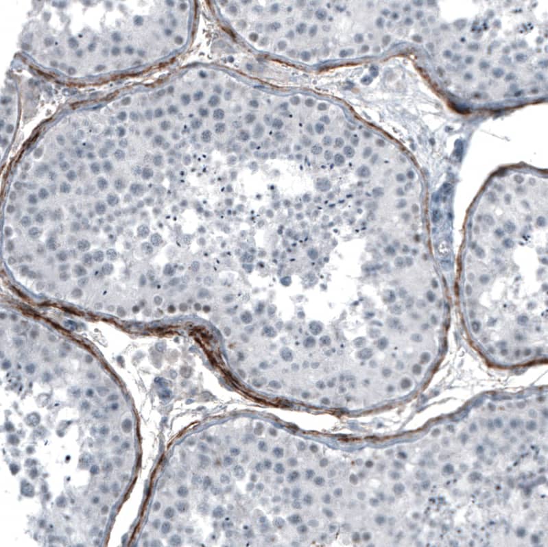 Staining of human testis shows moderate positivity of secretion around peritubular myoid cells.